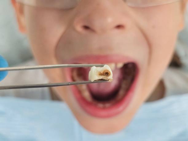 Best Walk-In Emergency Dental Services in Ellijay, GA